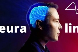 "Neuralink"in dəyəri 5 mlrd. dollara çatıb