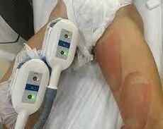 Arıqlama xidmətləri