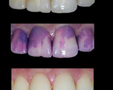 Europe Dental
