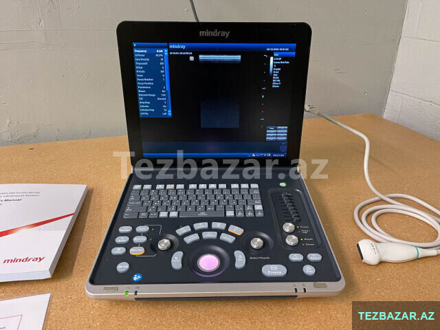 Mindray Z60 Diagnostic Ultrasound System Mindray Z60 Diagnostic Ultrasound System